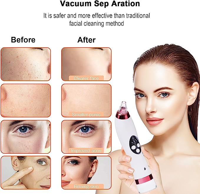 Aspirateur pour Points Noirs 2-en-1 : Nettoyage en Profondeur et Hydratation de la Peau